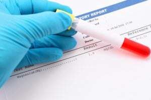 Vitamin D Testing